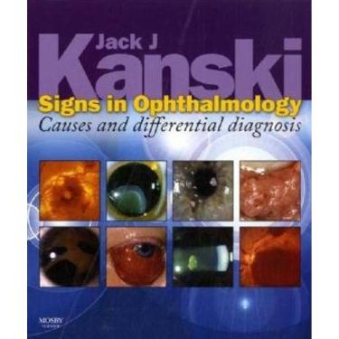 Imagem de Signs In Ophthalmology - Causes And Differential Diagnosis - Expert Consult