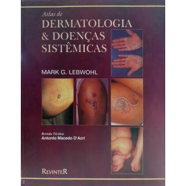 Imagem de Atlas De Dermatologia E Doencas Sistemicas - Revinter Rj