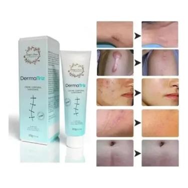 Imagem de Creme Pomada Para Cicatrizes 20g Tr - Tiarga & Inoue Cosméticos