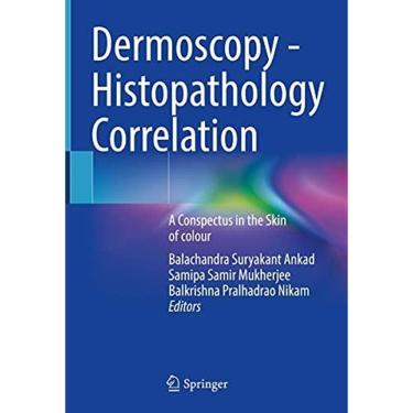 Imagem de Dermoscopy Histopathology Correlation
