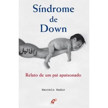 Imagem de Livro - Síndrome de Down