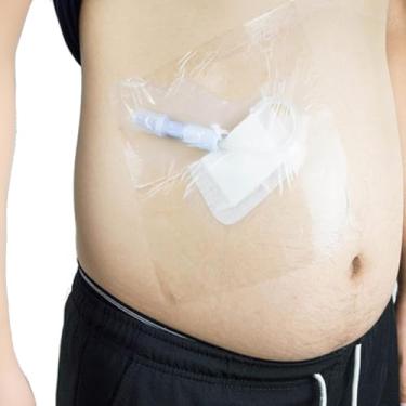 Imagem de Produtos De Cuidados Especiais Xuax Para Patiets De Diálise Peritoeal, Protetor De Chuveiro Descartável, Camada Impermeável De Cateter