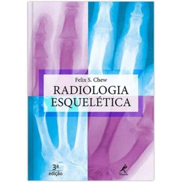 Imagem de Radiologia Esqueletica