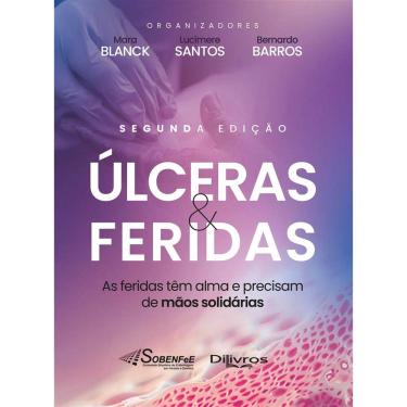 Imagem de Ulceras E Feridas