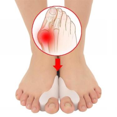 Imagem de Protetor Ortopédico Silicone Joanete Dedão Alivia Dores - Swg