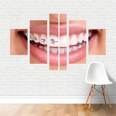 Imagem de Quadro Profissões Odontologia Dentista Aparelho Dentário Canvas - Plin