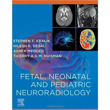Imagem de Fe Tal Neo Natal And Pedi Atric Neurorad Iology