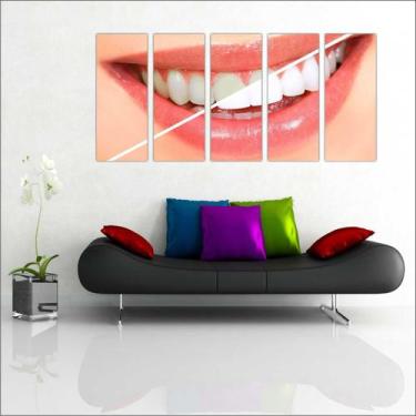 Imagem de Quadro Decorativo Consultórios Odontológicos Dentista 5 Peças GG5 - Vi