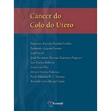 Imagem de Câncer Do Colo Do Útero - Tecmedd