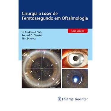 Imagem de Cirurgia A Laser De Femtossegundo Em Oftalmologia   Com Video