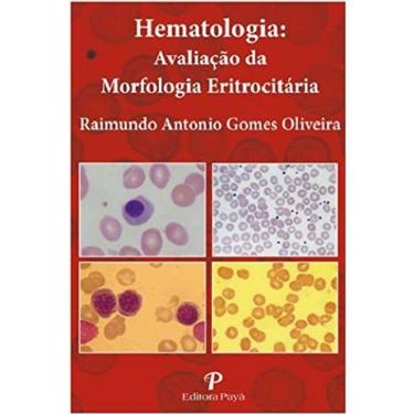 Imagem de Hematologia - Avaliação da Morfologia Eritrocitária - Pranchas