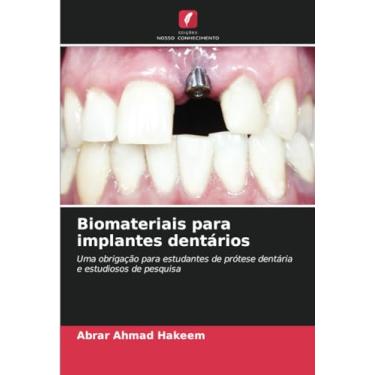 Imagem de Biomateriais para implantes dentários: Uma obrigação para estudantes de prótese dentária e estudiosos de pesquisa