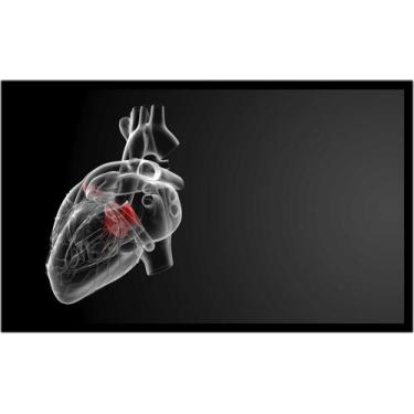 Imagem de Quadro Decorativo Medicina Médicos Coração Cardiologia Consultórios Co