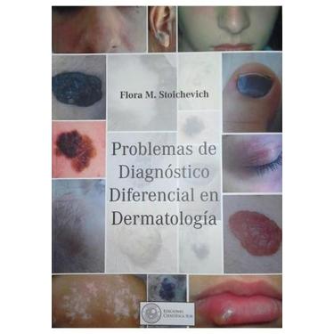 Imagem de Problemas De Diagnostico Diferencial En Dermatologia (Espanhol) - Edic