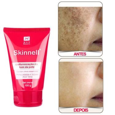 Imagem de Gel Creme para Manchas Escuras Skinnell 100gr - RHR