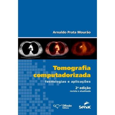 Imagem de Tomografia Computadorizada Tecnologias E Aplicacoes - 2º Ed