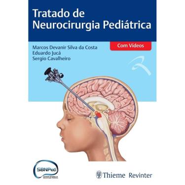Imagem de Tratado de Neurocirurgia Pediátrica