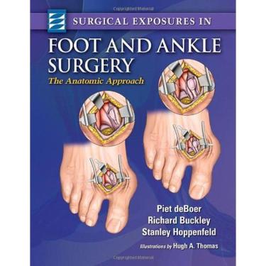 Imagem de Surgical Exposures In Foot & Ankle Surgery The Anatomic Approach