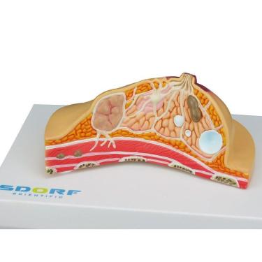 Imagem de Modelo Patológico de Mama SD-5209