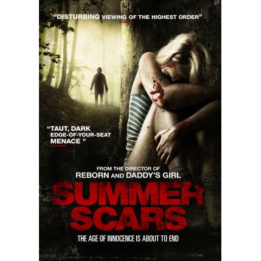 Imagem de SUMMER SCARS