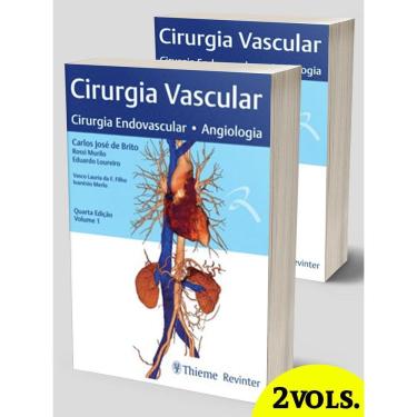 Imagem de Cirurgia Vascular Cirurgia Endovascular Angiologia 2 Vols