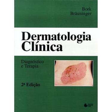Imagem de Dermatologia Clinica