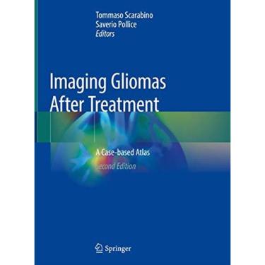 Imagem de Imaging Gliomas After Treatment