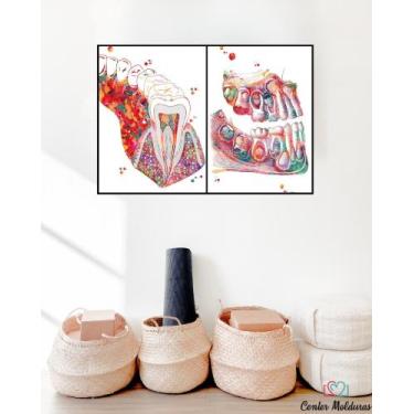 Imagem de quadros decorativos para consultório odontológico - Center Molduras