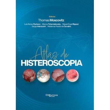 Imagem de ATLAS DE HISTEROSCOPIA, Autor: MOSCOVITZ/ THOMAS MOSCOVITZ - DI LIVROS