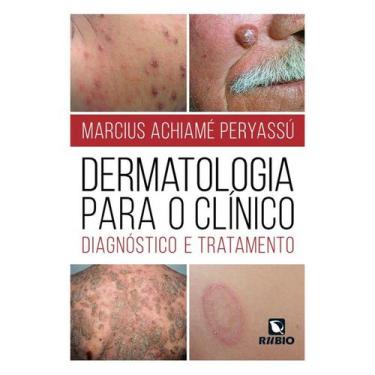 Imagem de Livro - Dermatologia Para O Clínico - Diagnostico E Tratamento - Perya
