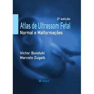 Imagem de Livro - Atlas de ultrassom fetal normal e malformações