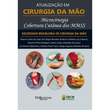 Imagem de Microcirurgia Cobertura Cutanea Dos Mmss Atualizacao Em Cirurgia Da Mao
