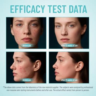 Imagem de Creme facial clareador com 10% de ácido azelaico – para uma pele mais suave e aparência de tom uniforme – não comedogênico, 30 ml