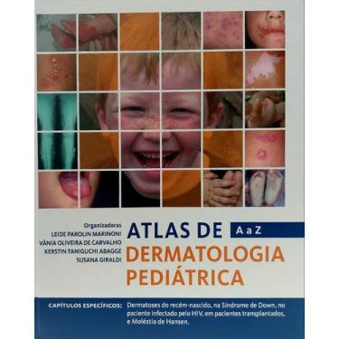 Imagem de Atlas de dermatologia pediatrica de a a z