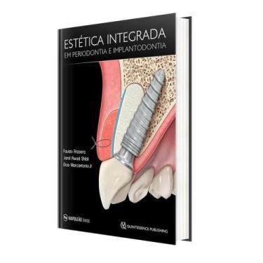 Imagem de Livro - Estética Integrada em Periodontia e Implantodontia - Frizzera 