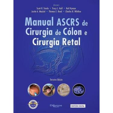 Imagem de Manual De Ascrs De Cirurgia De Colon E Cirurgia Retal