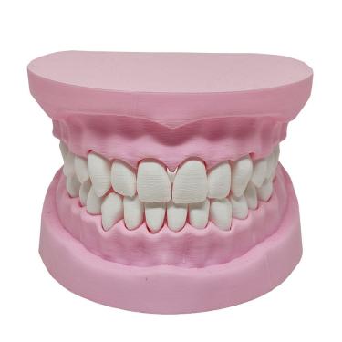 Imagem de Arcada Dentária Modelo 3d Dente Gengiva Boca Anatomia