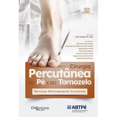Imagem de Cirurgia Percutanea Do Pe E Do Tornozelo:Tecnicas Minimamente Invasivas