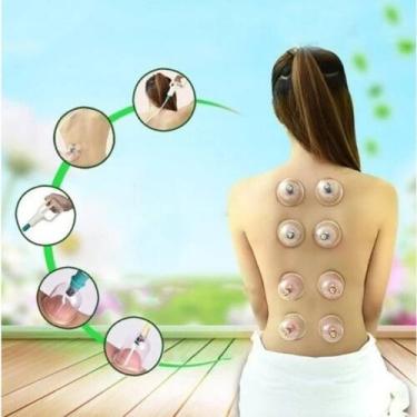 Imagem de Kit com 12 Ventosas para Massagem: Ventosaterapia, Acupuntura e Massot