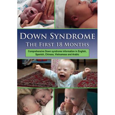 Imagem de Down Syndrome: The First 18 Months