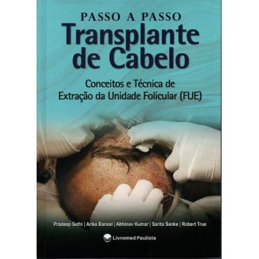 Imagem de Passo a Passo Transplante de Cabelo Conceitos e técnica de Extração da