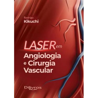 Imagem de Laser Em Angiologia E Cirurgia Vascular - Di Livros Editora Ltda-sp