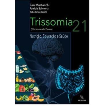 Imagem de Trissomia 21 (sindorme de Down) - MEMNON EDICOES CIENTIFICAS LTDA, 3