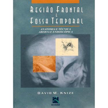 Imagem de Regiao Frontal E Fossa Temporal  Anatomia E Tecnica Aberta E Endoscopica