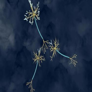 Imagem de Quadro Decorativo com Estampa de Atividade Elétrica do Cérebro para Conscientização Neurológica 50x50cm