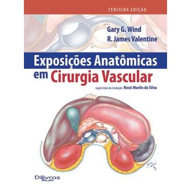 Imagem de Exposicoes anatomicas em cirurgia vascular - Di Livros Editora Ltda