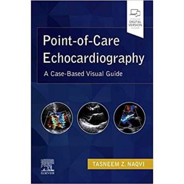 Imagem de Point-of-care Echocardiography