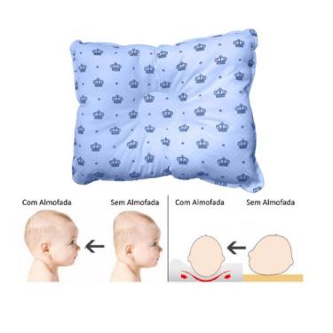 Imagem de Travesseiro Cabeça Chata Plagiocefalia Grande Bebê a partir de 3 meses