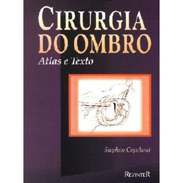 Imagem de Cirurgia Do Ombro Atlas E Texto