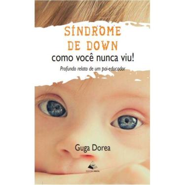 Imagem de Síndrome de Down como você nunca viu